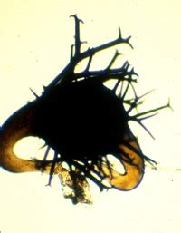 Phycomyces | Zygomycetes