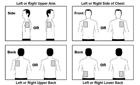 Transdermal Patch Placement Chart