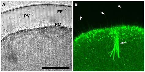 The spikes protruding into the perivitelline space during fertilization... | Download Scientific ...