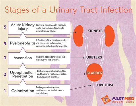 Urinary Tract Infection (UTI) - FastMed