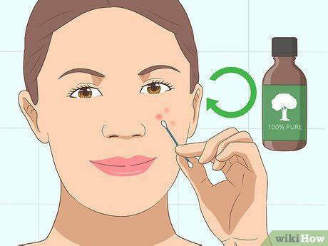 How to Use Tea Tree Oil for Acne: 12 Steps (with Pictures)