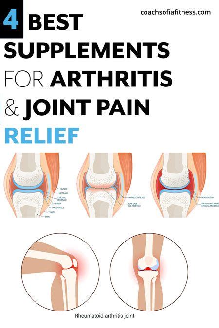 4 Important Arthritis & Joint pain Supplements For Relief - Coach Sofia ...