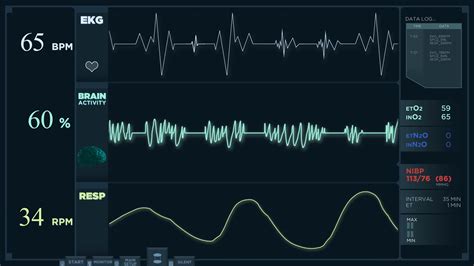 Electrocardiogram Animation