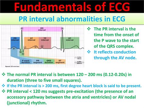 Approach to a patient with PR interval abnormality in ECG | PPT