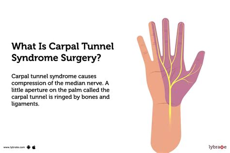 Carpal Tunnel Syndrome Surgery: Purpose, Procedure, Benefits and Side ...