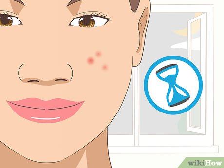 How to Use Tea Tree Oil for Acne: 12 Steps (with Pictures)