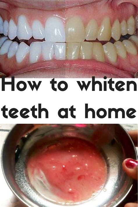 How To Remove Gutkha Stain From Teeth - TeethWalls