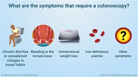 Slide Show - When should I get a colonoscopy and what do the results mean?