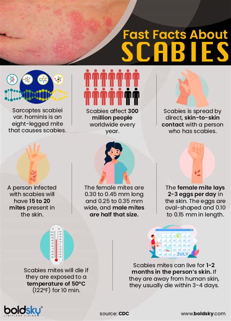 Scabies Symptoms And Treatment | Images and Photos finder