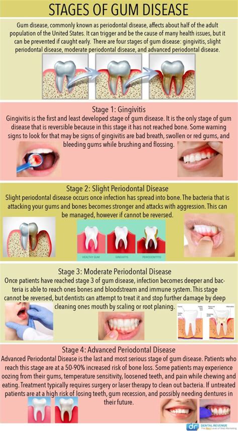 gum disease treatments - NewWriting-Publishing