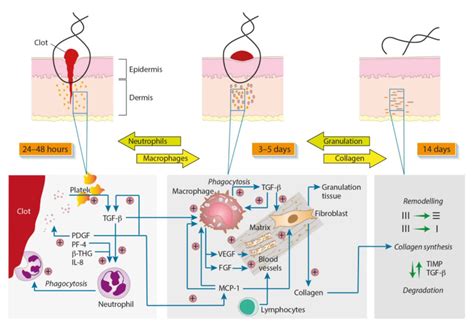 Phases of wound healing - RCEMLearning India