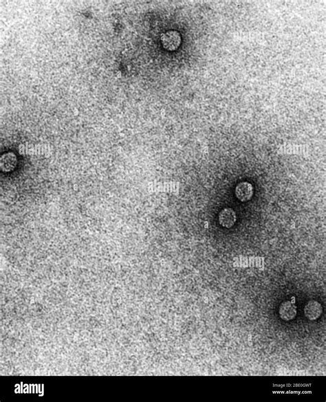 Transmission electron micrograph (TEM) of rhinoviruses, which cause the common cold ...