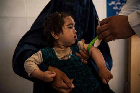 Half of Afghanistan’s Children Under 5 Expected to Face Severe Hunger