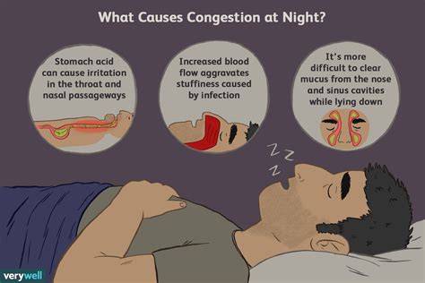 causes of nighttime congestion | Sinusitis, Headaches at night, Sinus ...