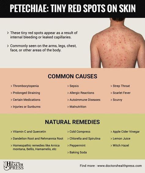 What Are These Tiny Red Spots On My Skin? Causes & Remedies | Skin spots, Red skin spots ...