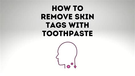 How To Remove Skin Tags With Toothpaste? - Power Tooth Paste