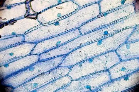 Onion Cells Under a Microscope - Requirements/Preparation/Observation