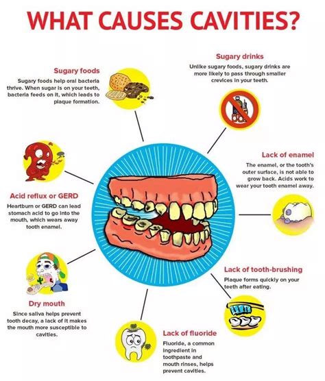 Tooth Decay: Causes And Prevention - Theron Coker - Medium