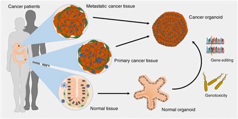 How Tumor Organoid Applications Help In Cancer Research | Kosheeka