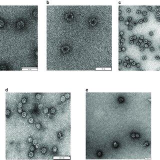 Negative staining transmission electron microscopy (NSTEM) analysis of... | Download Scientific ...