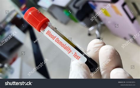 18 Osmolality Test Images, Stock Photos & Vectors | Shutterstock