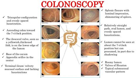 Colonoscopy- A Pictorial Overview