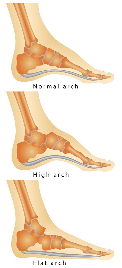 Arches Of Foot Diagram