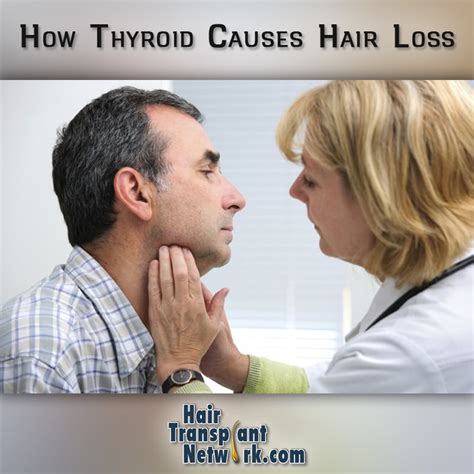 HOW THYROID CAUSES HAIR LOSS