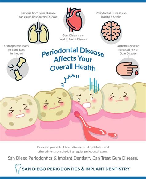 How Periodontal Disease Affects Your Overall Health