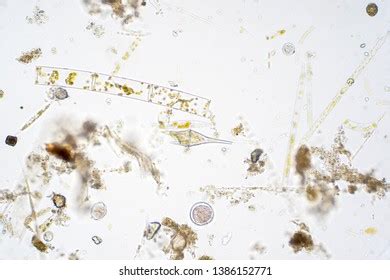 Marine Aquatic Plankton Under Microscope View Stock Photo (Edit Now) 1386152771