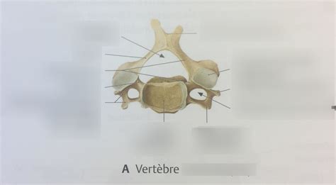 Vertèbre cervicale vue supérieur Diagram | Quizlet