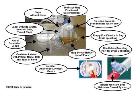 Urinary Catheter Drainage Bag Care - Best Drain Photos Primagem.Org