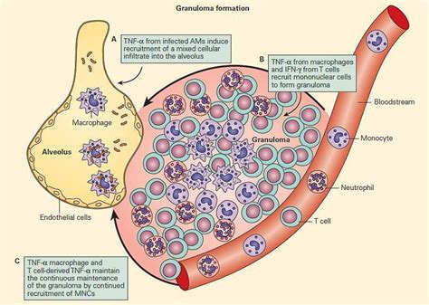 😎 Cause and effect of tuberculosis. On the “cause” of tuberculosis ...