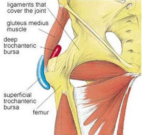 Trochanteric Bursitis: Sports Medicine Doctor Mesa AZ, Orthopedic Surgeon