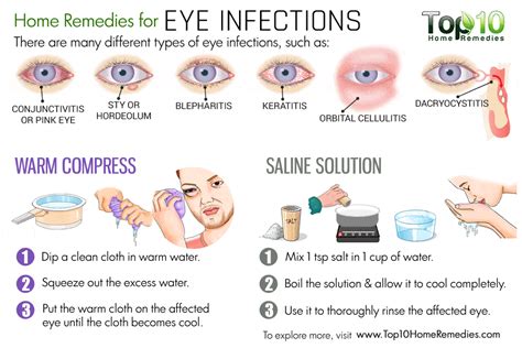 Home Remedies for Eye Infections | Top 10 Home Remedies