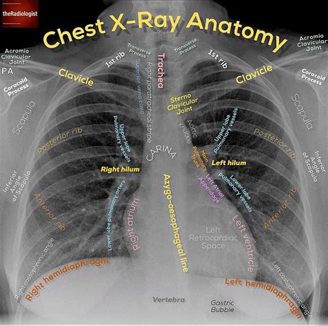 Pin on Radiology Anatomy