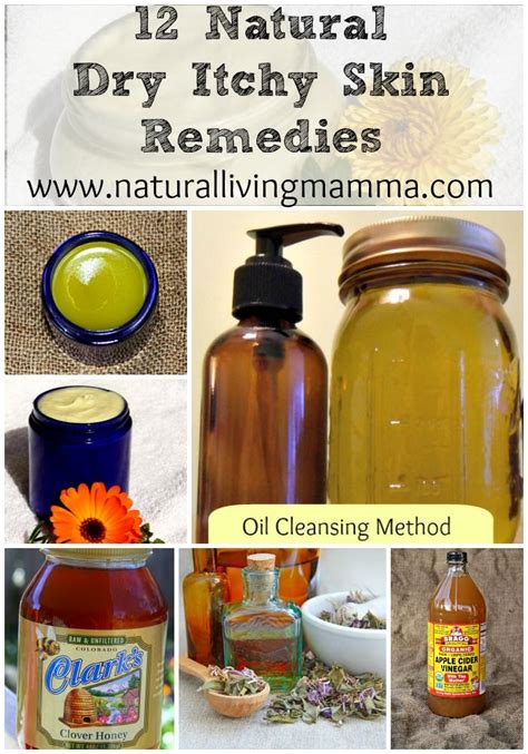 12 Natural Dry Itchy Skin Remedies - Natural Living Mamma | Dry itchy skin remedies, Dry itchy ...