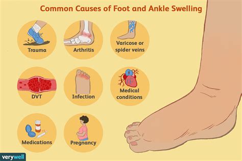 7 causes of swelling and water retention and what to do – Artofit