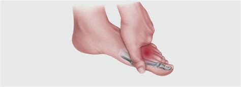 Shooting Pain Between your Toes: What Does it Mean? - Quality Foot Care