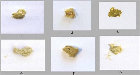 Pancreas: Yellow Stool Pancreas