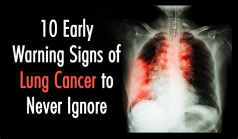 10 Early Warning Signs of Lung Cancer You Need to Know!