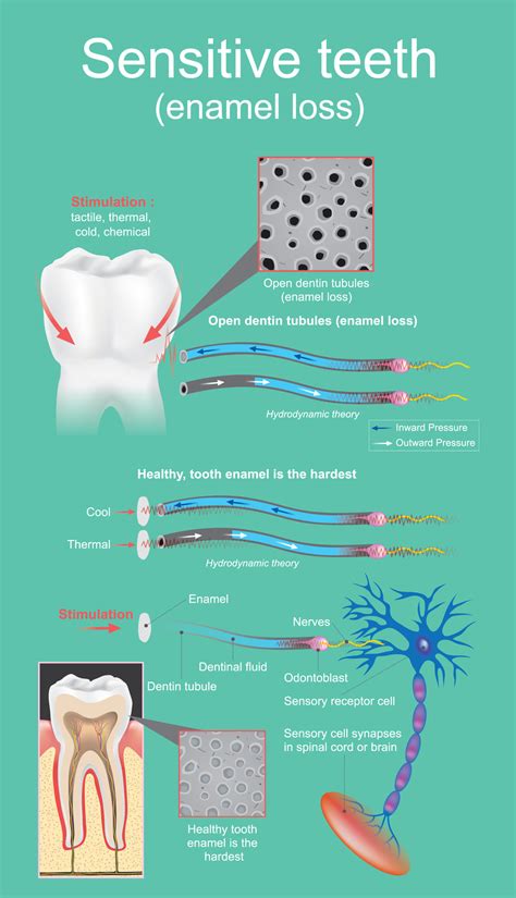 sensitive – Pottsville Beach Dental