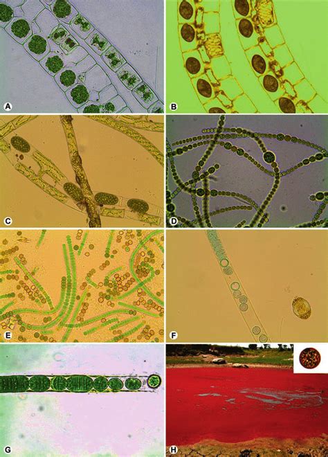 1 Resting spores seen in algae. (a) Zygospore formation in Zygnema sp.... | Download Scientific ...