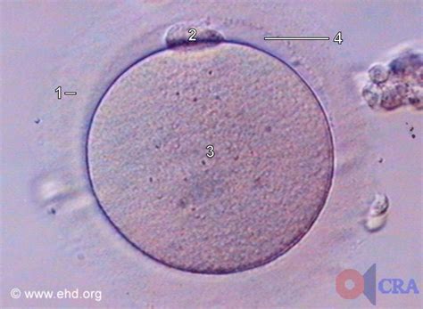 Secondary Oocyte