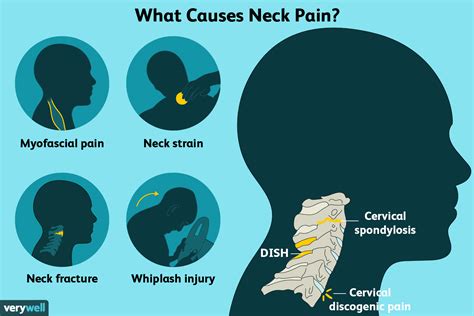 Neck Pain: Causes, Treatment, and When to See a Healthcare Provider