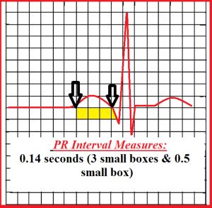 How to Measure the PR Interval on an EKG Strip | PR Interval EKG Quiz