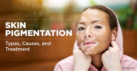 What Are the Different Types of Skin Pigmentation Disorders?