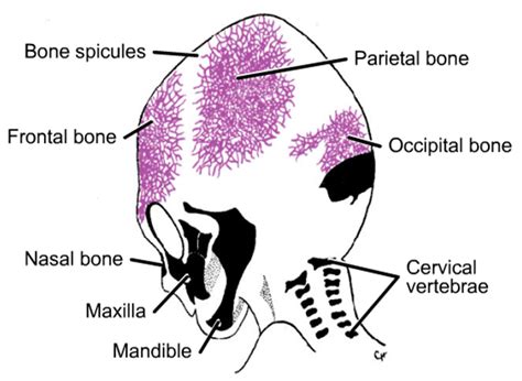 Development of Skull - DEVELOPMENT OF HUMAN SKELETAL SYSTEM