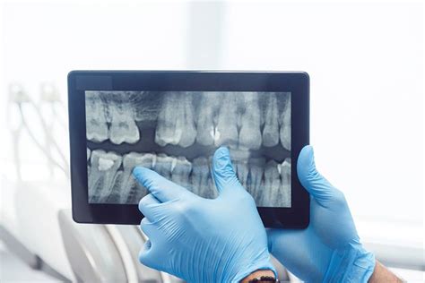 Discover 9 Benefits of Digital Dental X-Rays | myDental