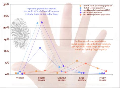 Radial loop fingerprints provide a clue for Down syndrome! | Palm ...